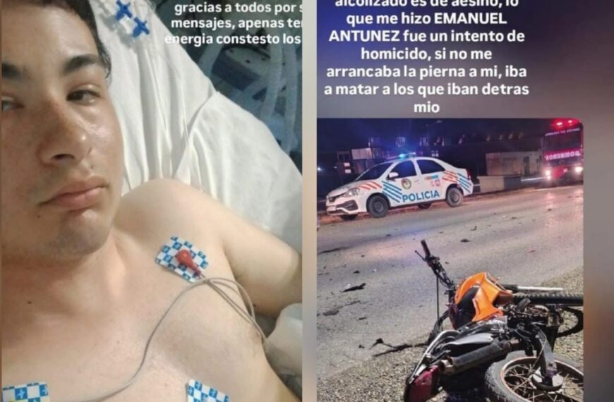 Habló el joven motociclista que perdió una pierna tras violento accidente